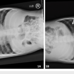 Left lateral decubitus x ray