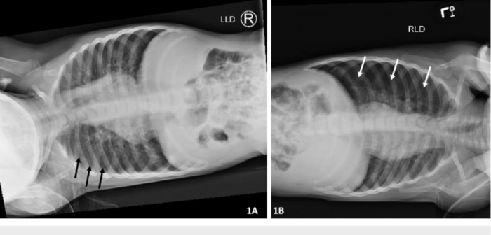 Left lateral decubitus x ray