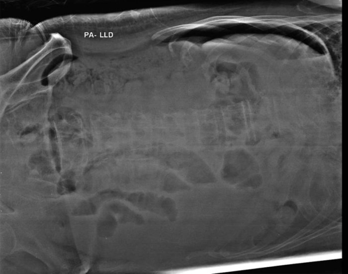 Left lateral decubitus x ray