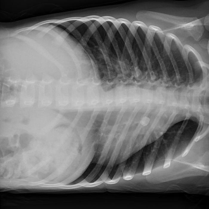 Chest decubitus supine lateral types rays